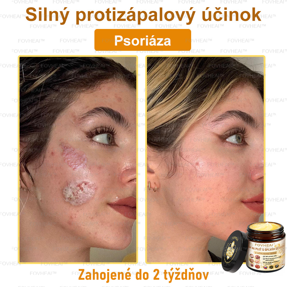 💎🐝💎FOVHEAl™ Krém na pleť s úplným účinkom z včelieho jedu - 🧑⚕️Odporúčané dermatológmi - Vhodné pre všetky vekové kategórie