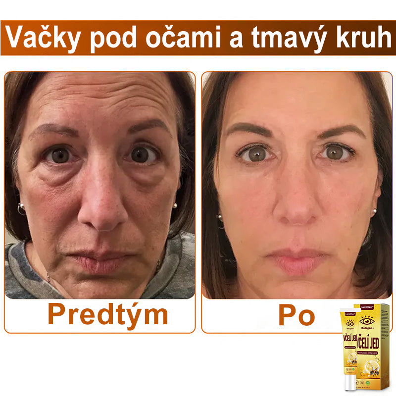 🌻LumiOko™ Kolagén+ Včelí Jed Prebúdzací Očný Krém - Odporúčané dermatológom - Získalo certifikát CE