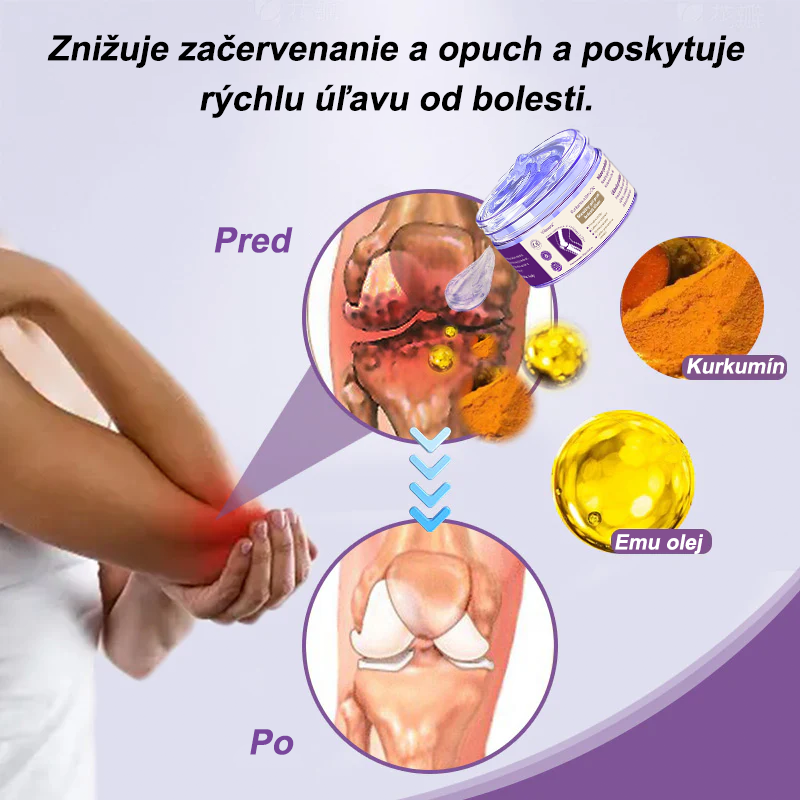 🪻Viloxera™ Kurkuma a Emu Olej Masážny gél proti bolesti kĺbov👨⚕️Schválené Slovenskou ortopedickou spoločnosťou (SOTS)