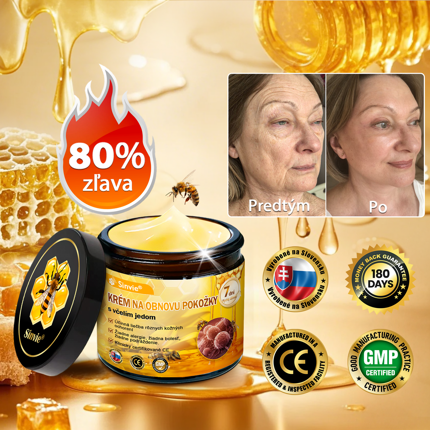 💛Sinvie® Krém na obnovu pokožky s včelím jedom 🔥 Odporúčané dermatológmi | Proti vráskam, pigmentovým škvrnám a ochabnutej pokožke – 50 ml