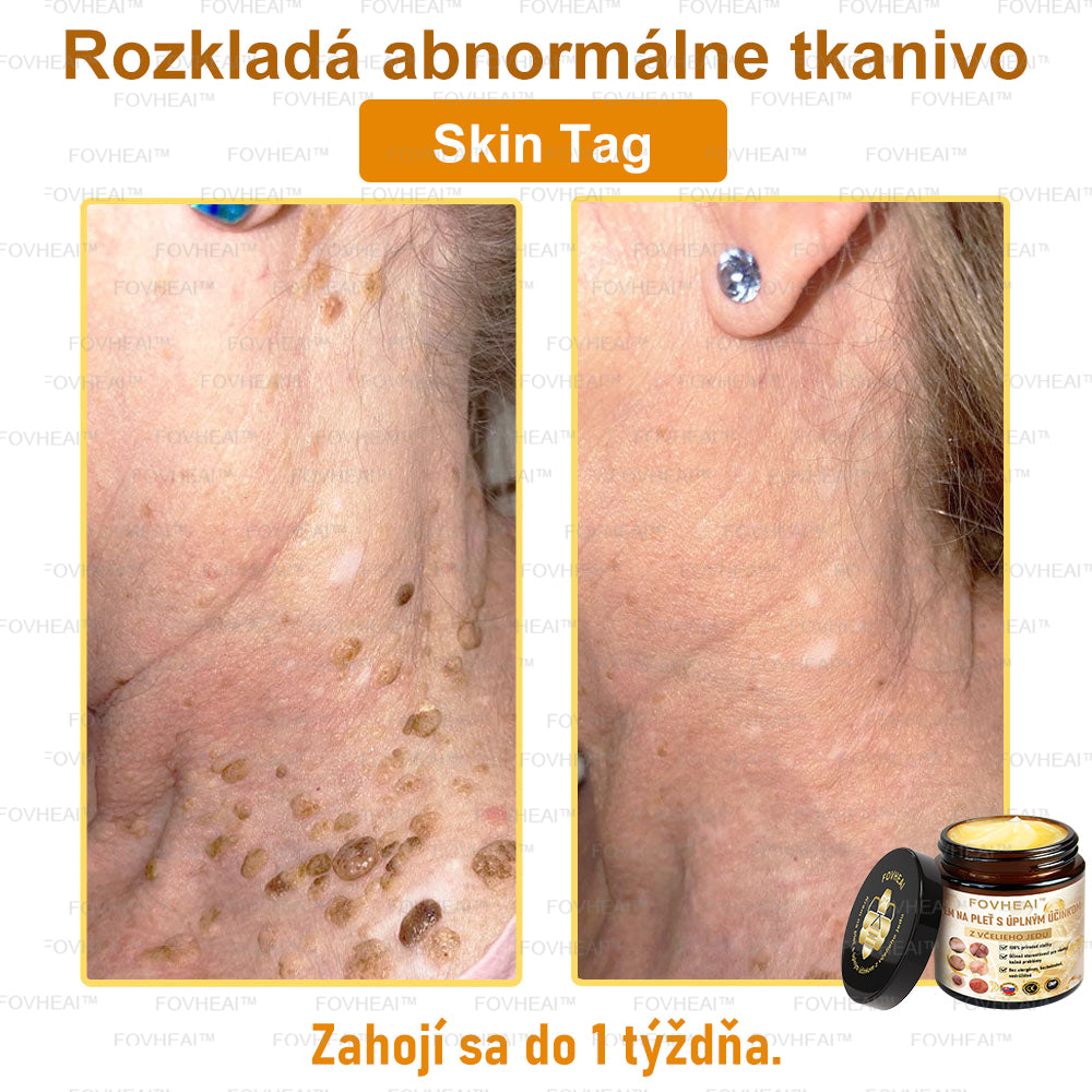 💎🐝💎FOVHEAl™ Krém na pleť s úplným účinkom z včelieho jedu - 🧑⚕️Odporúčané dermatológmi - Vhodné pre všetky vekové kategórie