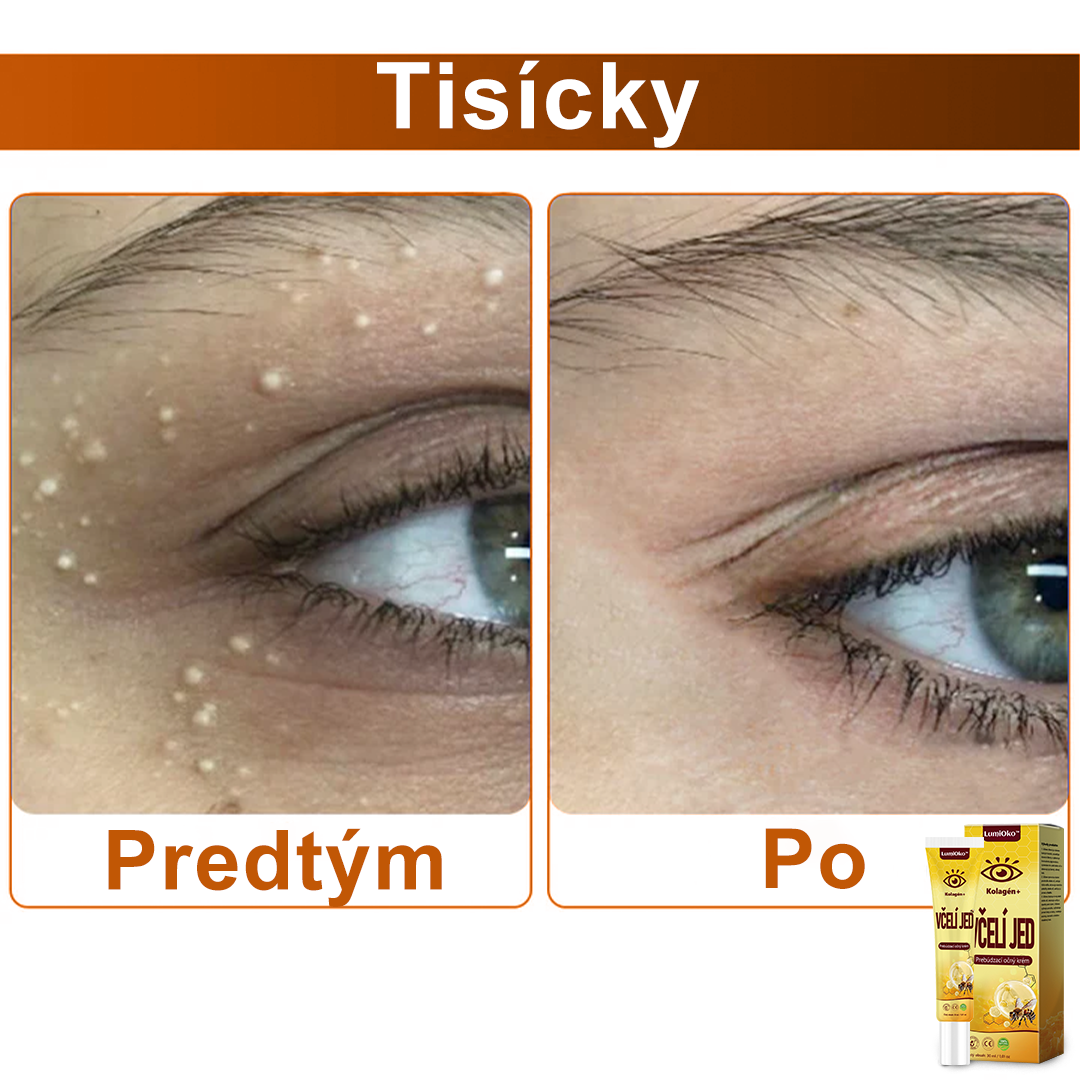 🌻LumiOko™ Kolagén+ Včelí Jed Prebúdzací Očný Krém - Odporúčané dermatológom - Získalo certifikát CE