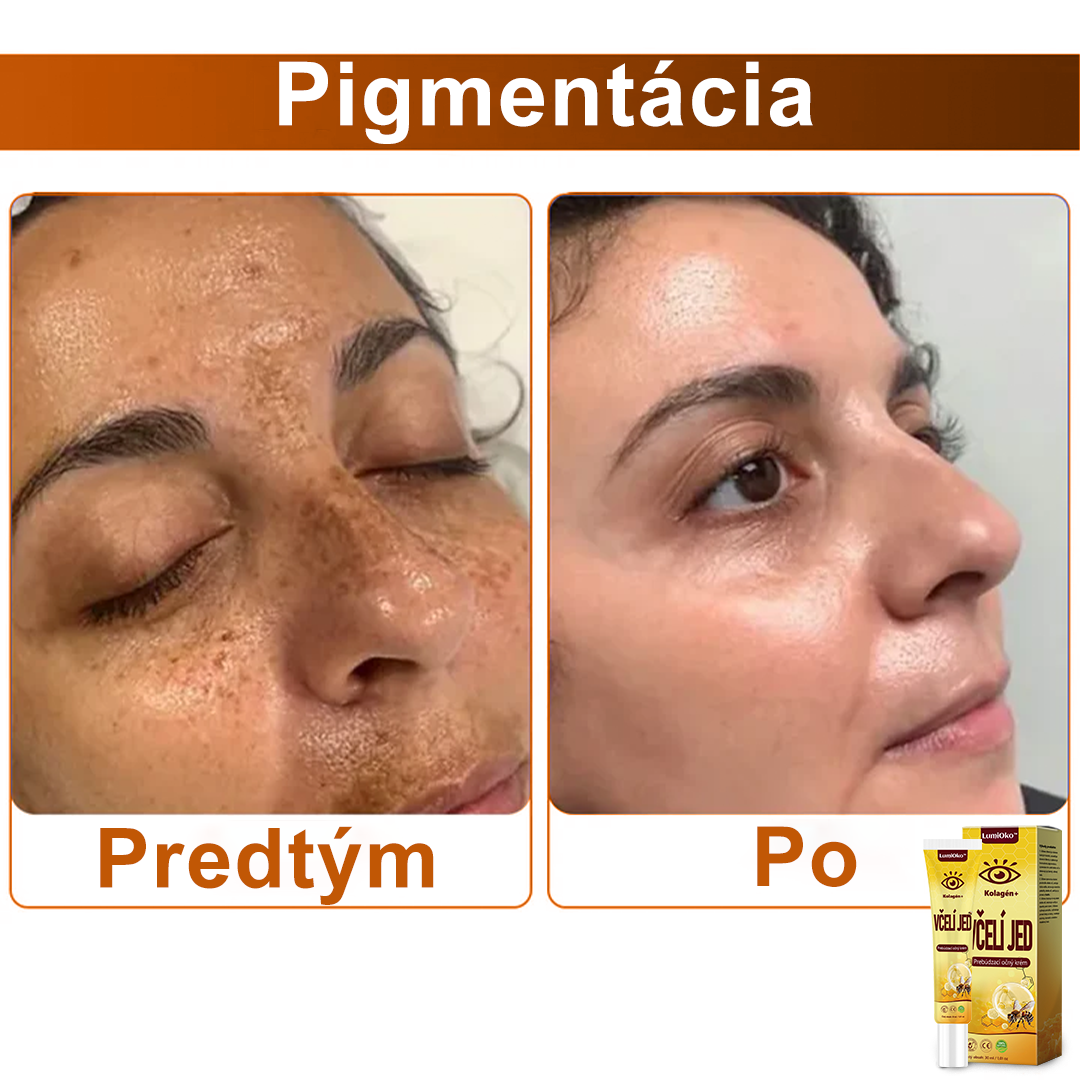 🌻LumiOko™ Kolagén+ Včelí Jed Prebúdzací Očný Krém - Odporúčané dermatológom - Získalo certifikát CE