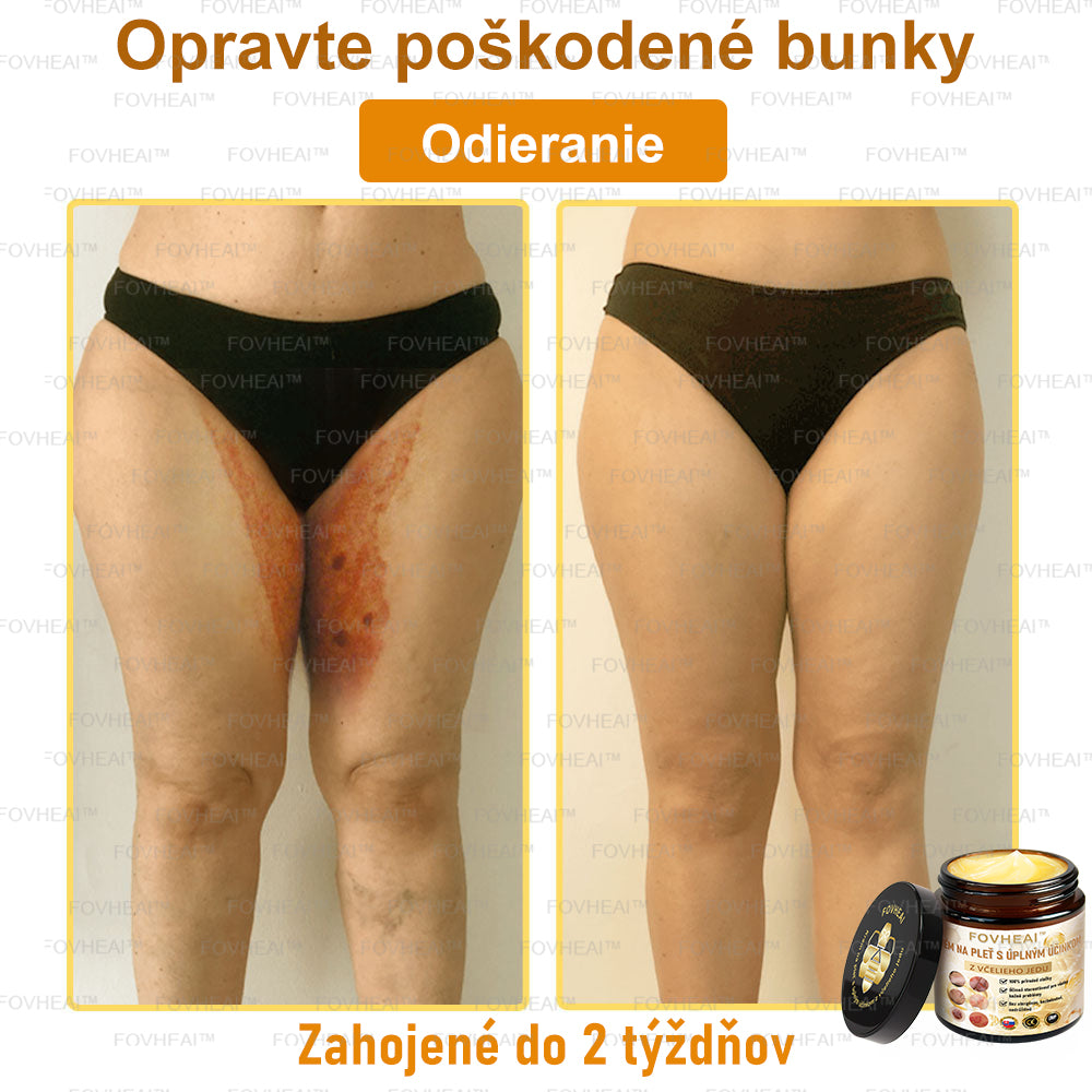 💎🐝💎FOVHEAl™ Krém na pleť s úplným účinkom z včelieho jedu - 🧑⚕️Odporúčané dermatológmi - Vhodné pre všetky vekové kategórie