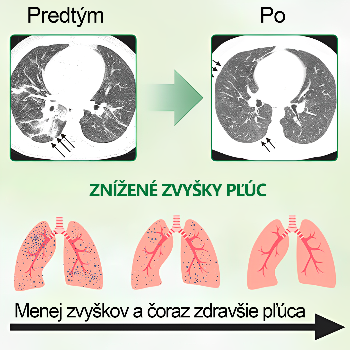 🌿𝐆𝐨𝐨𝐲𝐞𝐞𝐫™ Vysoko kvalitný pľúcny sprej -🧑⚕️ Podporuje zdravie pľúc, priedušiek a dutín, podporuje zdravie dýchacieho systému a ľahšie dýchanie