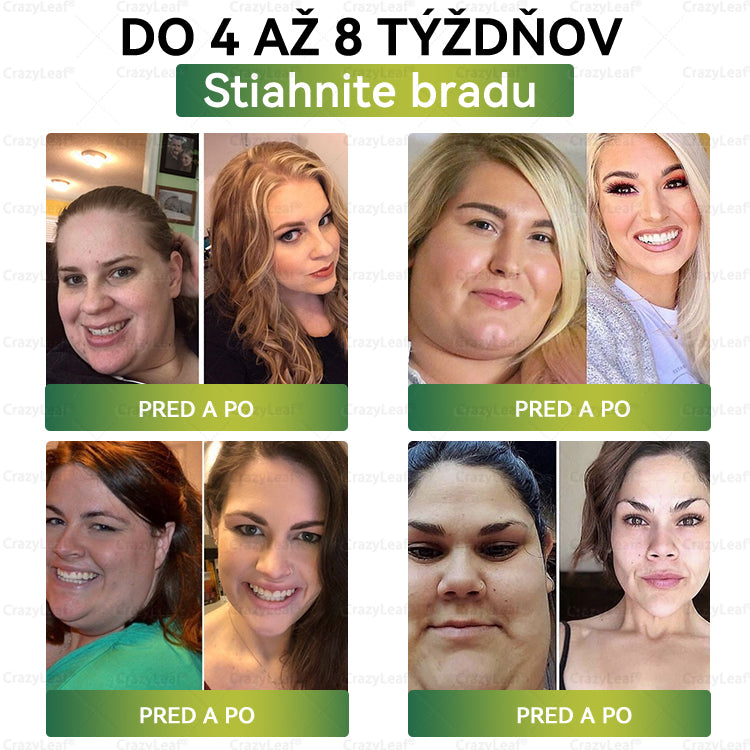 🍀🍀CrazyLeaf® Meglutide GLP-1 Aktivujúci Orálny Roztok ✅Obezita, kardiovaskulárne ochorenia, cukrovka, spánkové apnoe, problémy s kĺbmi a ďalšie