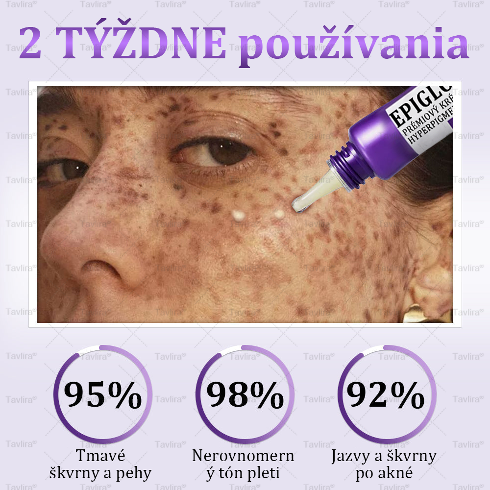 💜Tavlira® EPIGLOW MelanEX Prémiový krém proti hyperpigmentácii | ✅Schválené zdravotníckym oddelením Slovenska