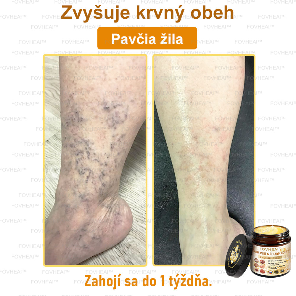 💎🐝💎FOVHEAl™ Krém na pleť s úplným účinkom z včelieho jedu - 🧑⚕️Odporúčané dermatológmi - Vhodné pre všetky vekové kategórie