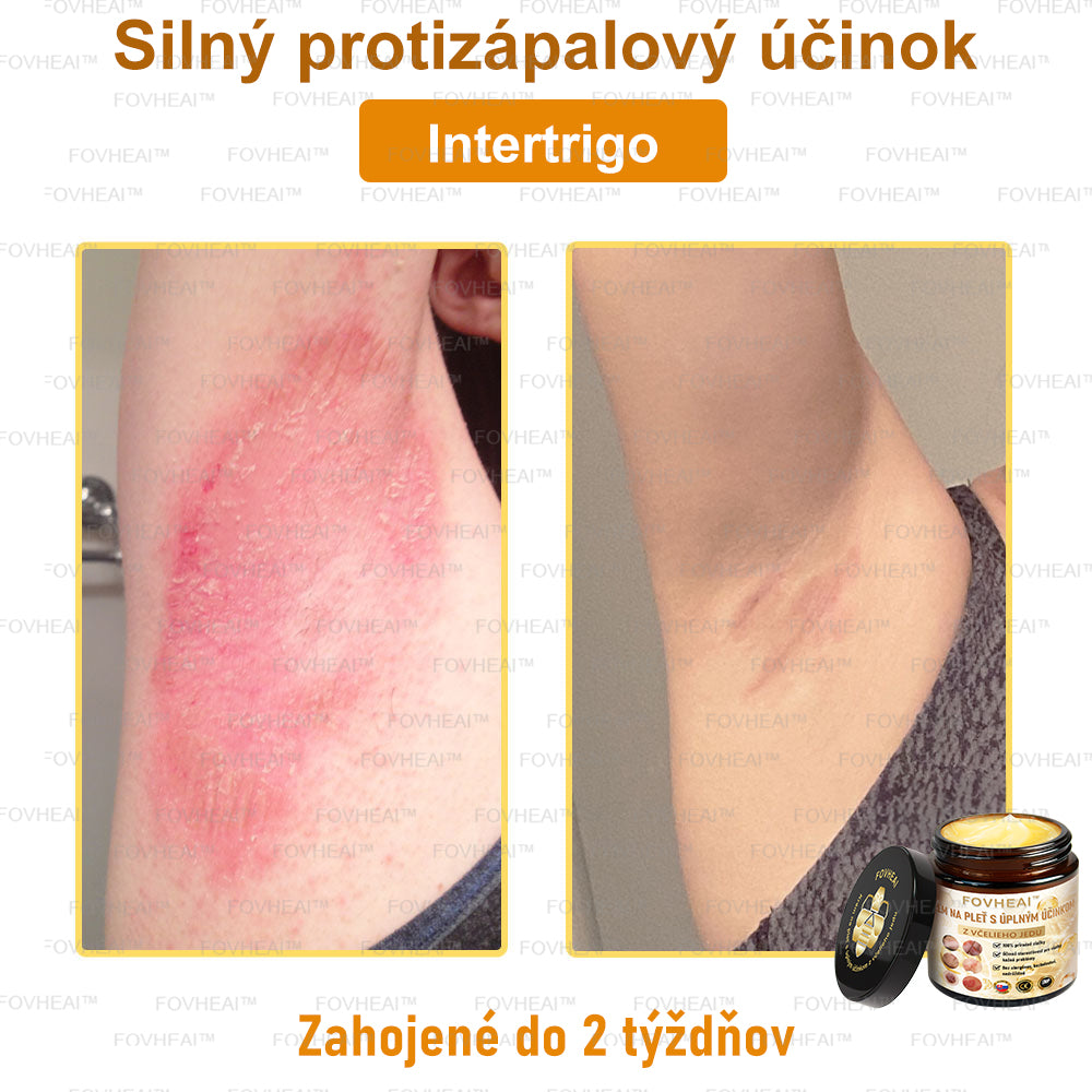 💎🐝💎FOVHEAl™ Krém na pleť s úplným účinkom z včelieho jedu - 🧑⚕️Odporúčané dermatológmi - Vhodné pre všetky vekové kategórie