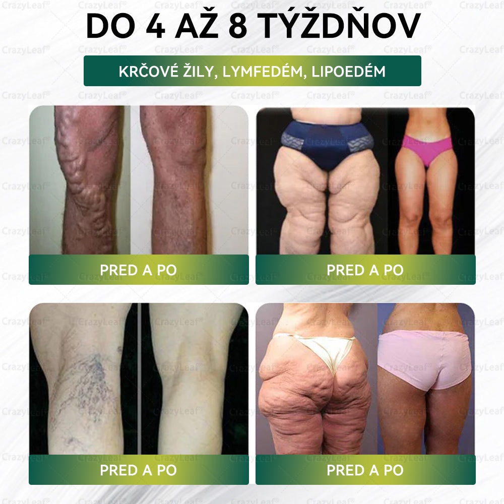 🍀🍀CrazyLeaf® Meglutide GLP-1 Aktivujúci Orálny Roztok ✅Obezita, kardiovaskulárne ochorenia, cukrovka, spánkové apnoe, problémy s kĺbmi a ďalšie