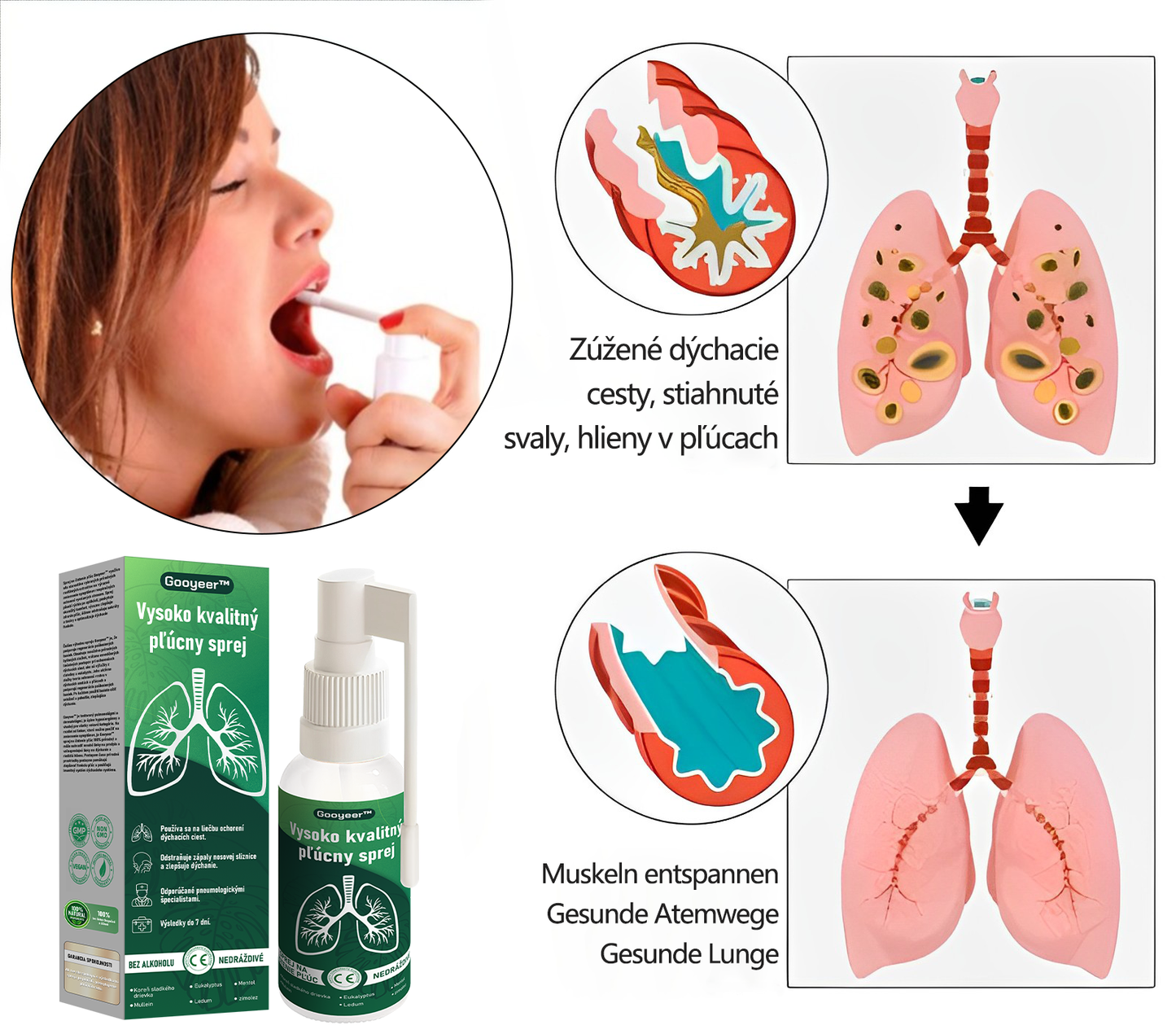 🌿𝐆𝐨𝐨𝐲𝐞𝐞𝐫™ Vysoko kvalitný pľúcny sprej -🧑⚕️ Podporuje zdravie pľúc, priedušiek a dutín, podporuje zdravie dýchacieho systému a ľahšie dýchanie