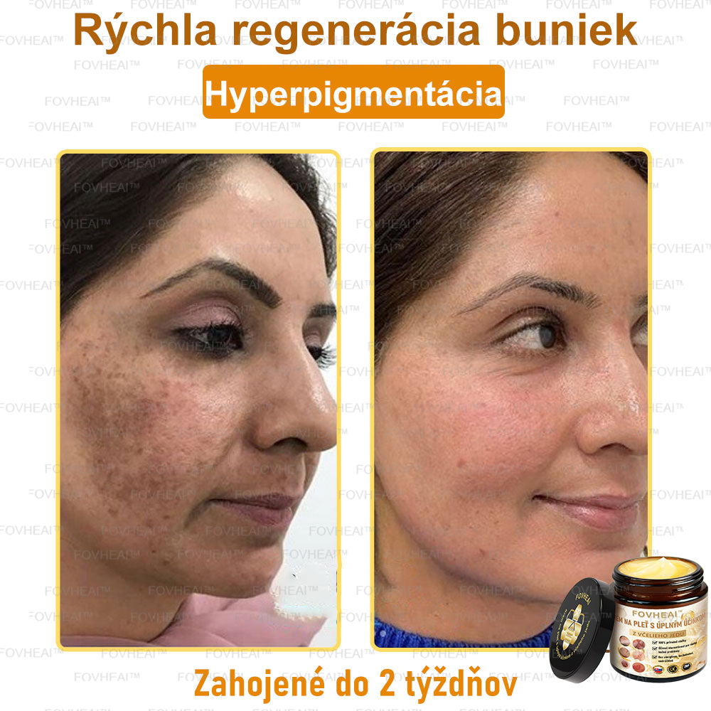 💎🐝💎FOVHEAl™ Krém na pleť s úplným účinkom z včelieho jedu - 🧑⚕️Odporúčané dermatológmi - Vhodné pre všetky vekové kategórie