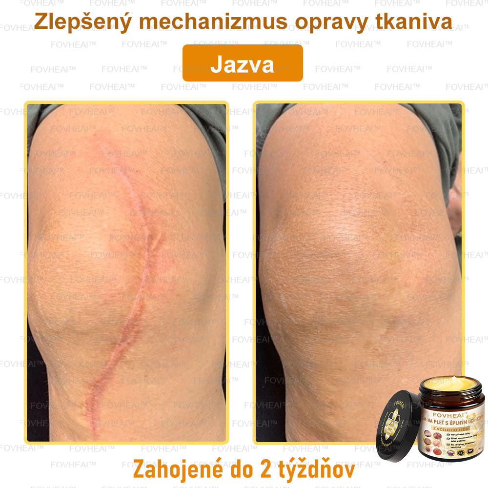 💎🐝💎FOVHEAl™ Krém na pleť s úplným účinkom z včelieho jedu - 🧑⚕️Odporúčané dermatológmi - Vhodné pre všetky vekové kategórie