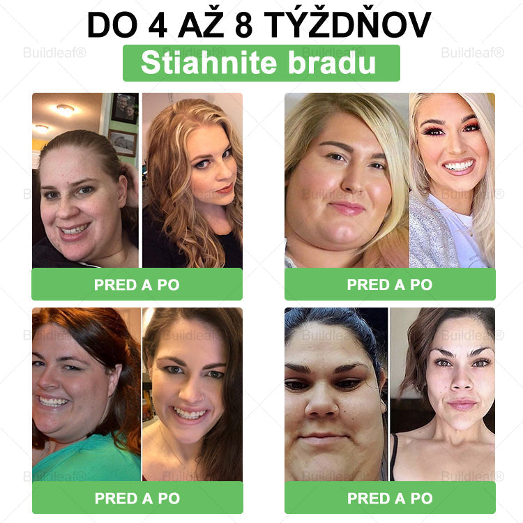 🍏🍏BuildLeaf® GLP-1 6-v-1 Fit & Vital Perorálny Roztok ✅ (Len raz denne, viditeľné zmeny už za 7 dní) Pre obezitu, kardiovaskulárne ochorenia, cukrovku, spánkové apnoe, zdravie čriev, problémy s kĺbmi a ďalšie