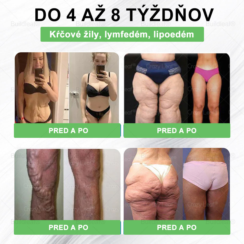 🍏🍏BuildLeaf® GLP-1 6-v-1 Fit & Vital Perorálny Roztok ✅ (Len raz denne, viditeľné zmeny už za 7 dní) Pre obezitu, kardiovaskulárne ochorenia, cukrovku, spánkové apnoe, zdravie čriev, problémy s kĺbmi a ďalšie