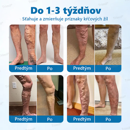 💙Trimil® Bylinný Sprej na Ochranu Žíl - ✅ Klinicky preukázané: Kŕčové žily zmiznú už za 7 dní!