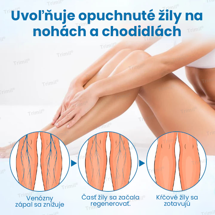 💙Trimil® Bylinný Sprej na Ochranu Žíl - ✅ Klinicky preukázané: Kŕčové žily zmiznú už za 7 dní!