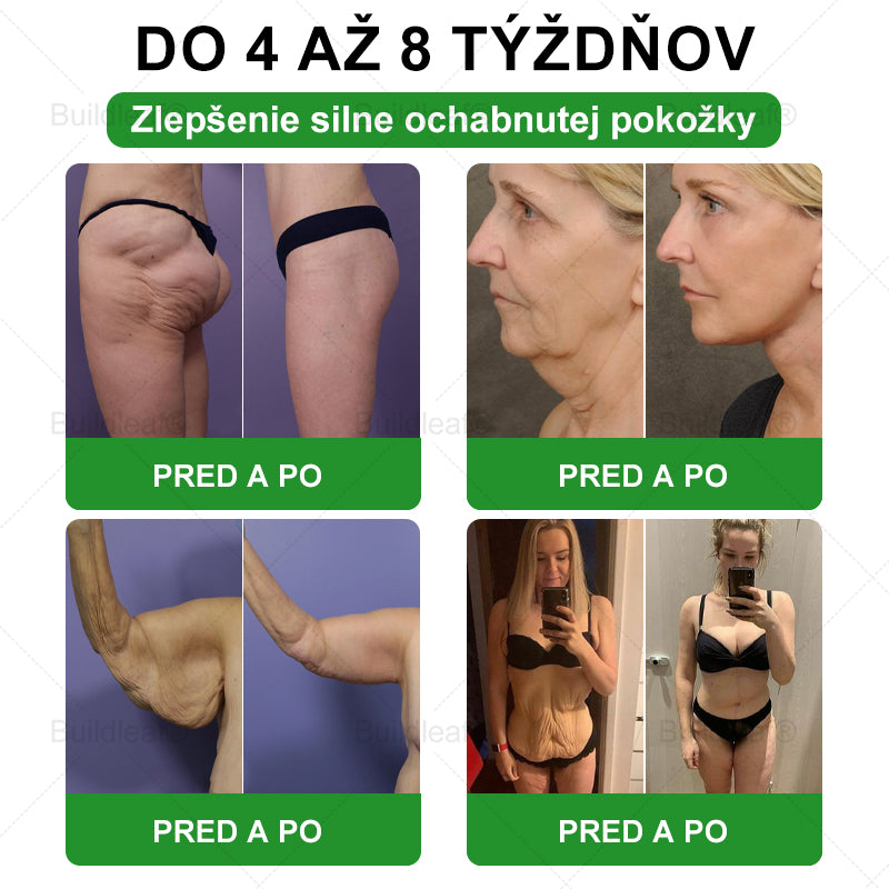 🍏🍏BuildLeaf® GLP-1 6-v-1 Fit & Vital Perorálny Roztok ✅ (Len raz denne, viditeľné zmeny už za 7 dní) Pre obezitu, kardiovaskulárne ochorenia, cukrovku, spánkové apnoe, zdravie čriev, problémy s kĺbmi a ďalšie