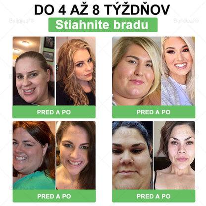 🍏🍏BuildLeaf® GLP-1 6-v-1 Fit & Vital Perorálny Roztok ✅ (Len raz denne, viditeľné zmeny už za 7 dní) Pre obezitu, kardiovaskulárne ochorenia, cukrovku, spánkové apnoe, zdravie čriev, problémy s kĺbmi a ďalšie